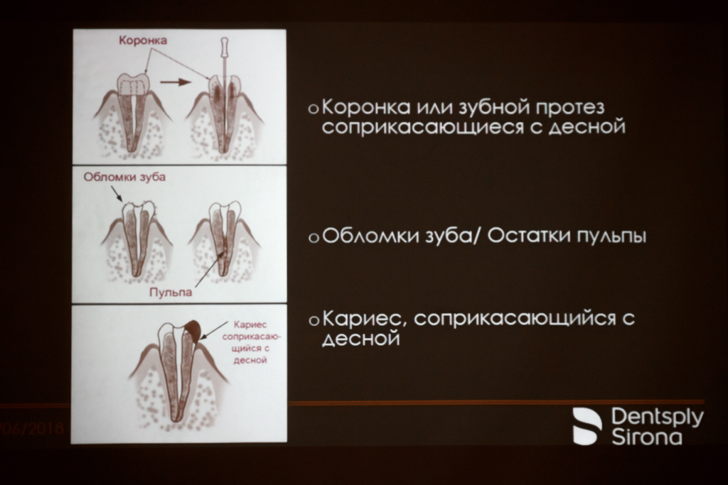 Cубъективно-объективная эндодонтия