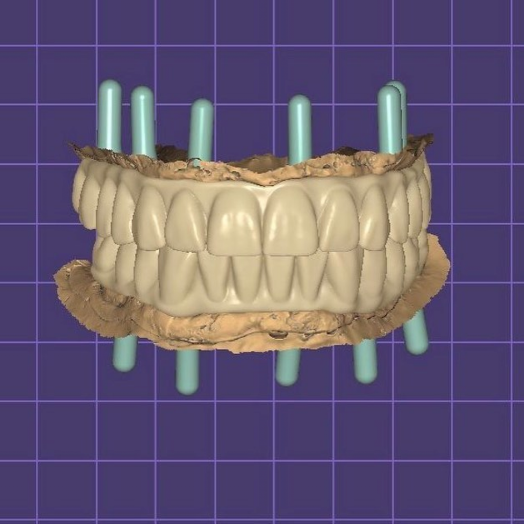 5.png
